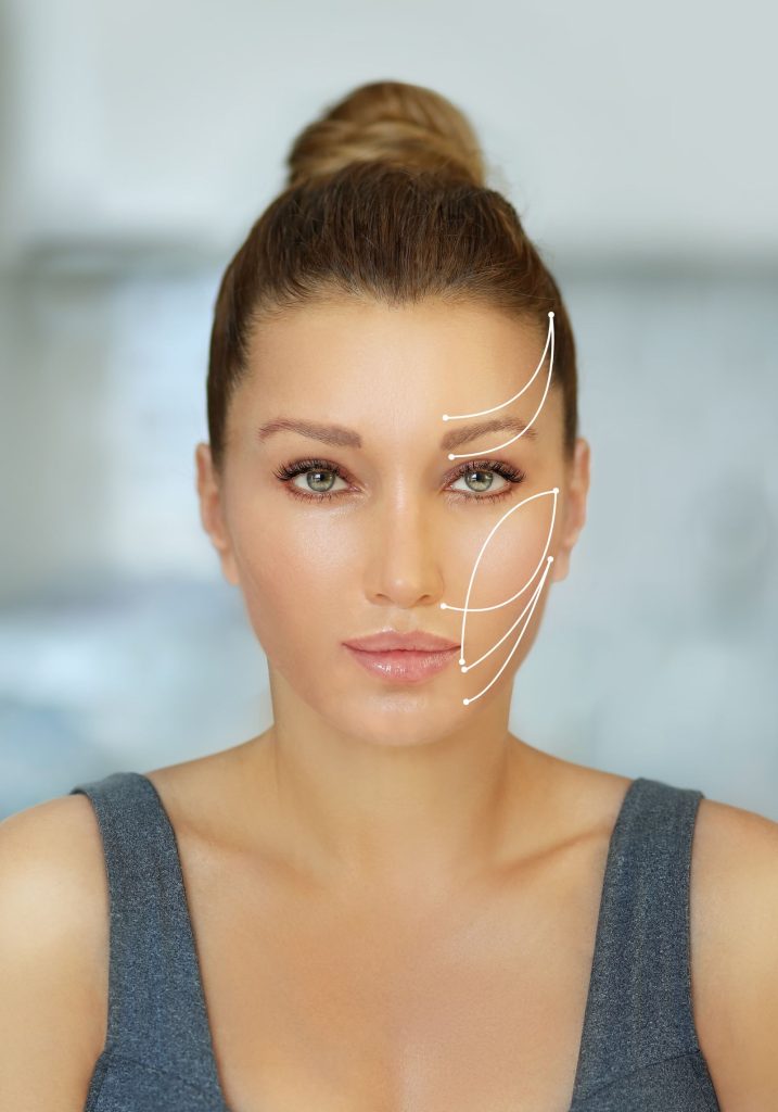 Zugfäden PDO Hannover